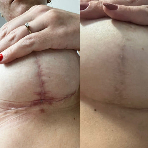 Facial Faces Healthiz com Ácido Hialurônico – 180 Dias