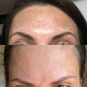 Facial Faces Healthiz com Ácido Hialurônico – 180 Dias