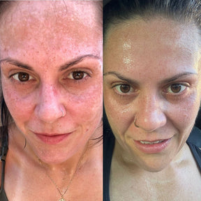 Facial Faces Healthiz com Ácido Hialurônico – 60 Dias