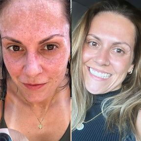 Facial Faces Healthiz com Ácido Hialurônico – 180 Dias