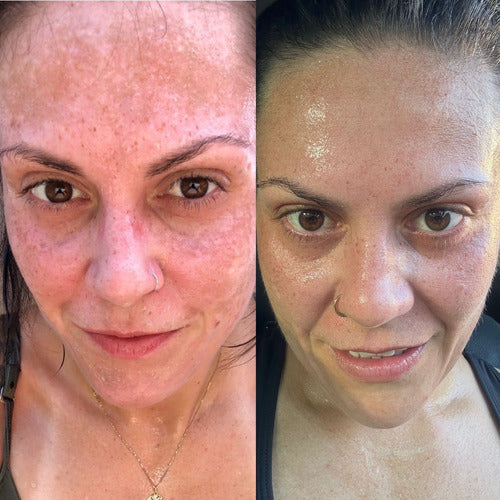 Faces Healthiz com Ácido Hialurônico – 30 dias