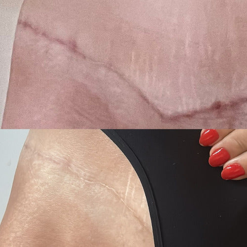 Facial Faces Healthiz com Ácido Hialurônico – 60 Dias